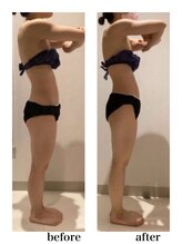 銀座レイア/ボディビフォーアフター