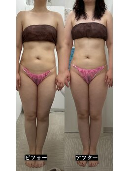 メリアミーゴ(Meli amigo)/お腹引き締め