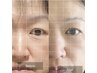 【美と健康を叶える】NMN吸入＋水素吸入＋フェイシャル60分7150円