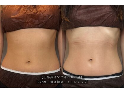 インディバサロンドアール 六本木(INDIBA Salon de R)の写真