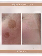 ミーラブ 鹿児島(miilove)/