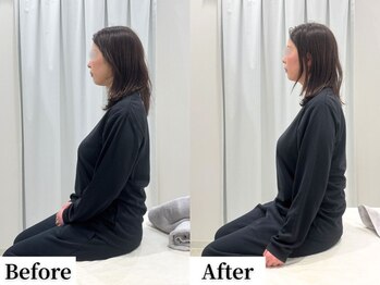 ソレア(Solea)/肩こり・巻き肩改善1回目