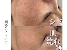 レナセール(Renacer)