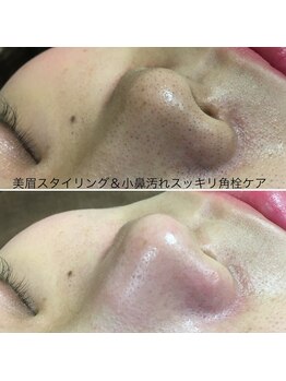 美眉アンド美肌専門サロンすみれ/ビフォーアフター