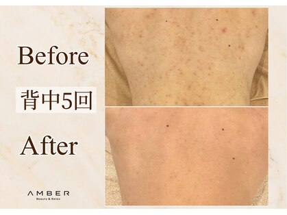 アンバー 恵比寿(AMBER)の写真