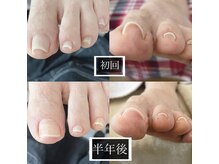 ヘアーアンドネイル フレンチ(French)の雰囲気（巻爪ケアも得意なサロンです）