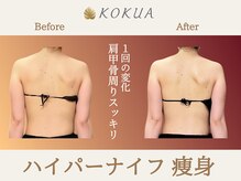 痩身専門店エステティックサロン コクア(KOKUA)