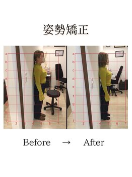 心斎橋長堀フェムテック整骨院/4姿勢矯正　骨格矯正と骨盤矯正