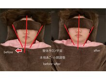 整体サロン宇宙/☆本格あご・小顔矯正☆