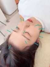 ヒーリングサロン アージュ(A-je)/★美顔鍼＋小顔矯正★
