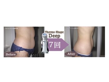 Nビューティー/最新エンダモロジーBODY