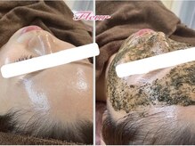 フルール(Fleur)/◆透明感/発光肌/憧れ美肌◆