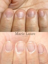 マリーロール 梅田店(Marie Laure)/深爪矯正/自爪育成/ネイルケア