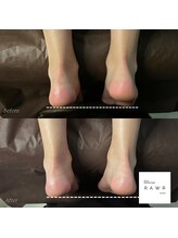 ロアー 赤坂店(RAWR)/足の長さの変化！