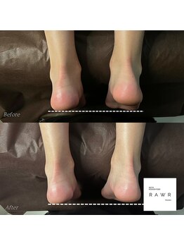 ロアー 赤坂店(RAWR)/足の長さの変化!