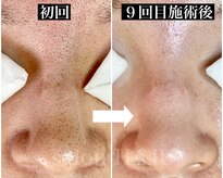 サロンハジュ(salon HAJU)