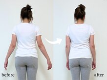 エーアール(AR)/【Before/After】