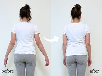 エーアール(AR)/【Before/After】