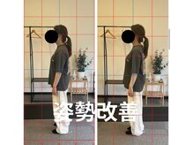 カワル整体 長嶺院/姿勢矯正