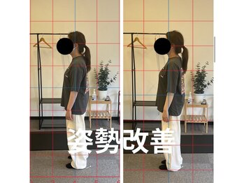 カワル整体 長嶺院/姿勢矯正