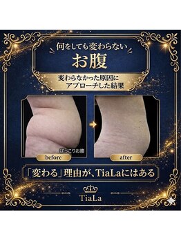 メンズアンドレディース エステティックサロン ティアラ(TiaLa)の写真/【短期集中プランあり！】360度どこから見ても誰もが憧れるスタイルへ…♪