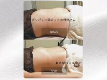 わたしのネイルとよもぎ蒸し/