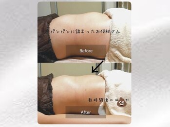 わたしのネイルとよもぎ蒸し/
