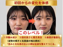 メディピークス/初回の変化