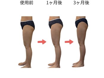 テラスアップ(Terrace UP)の写真/【ペルケア/山口県初導入】30分座るだけで3万回の筋肉運動！腰・ヒップ周りもスッキリ！姿勢改善にも！！