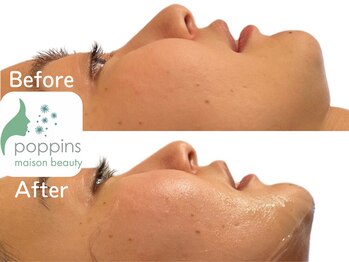 メゾンビューティーポピンズ 恵比寿(maisonbeauty poppins)