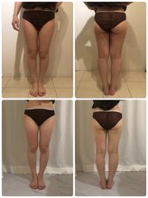 美人バスト 渋谷店/【痩身・ダイエット】 渋谷/脚☆