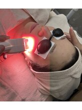 アールフェイスバランス/強く美しいお肌へ★プロスキン5