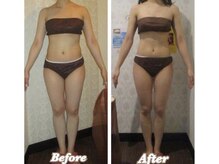 アンリール 旭川店(Anrire)/BODY施術のお客様です！