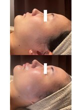 ディオーネ 春日井勝川店(Dione)/マーメイド☆ビフォーアフター