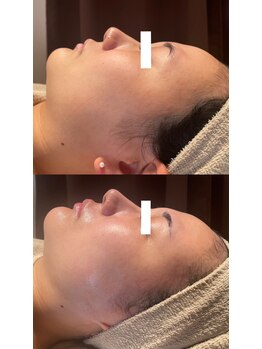 ディオーネ 春日井勝川店(Dione)/マーメイド☆ビフォーアフター