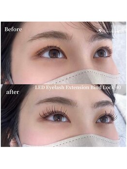 スウィートアイズ(Sweet eyes)/LEDバインドロック 40束