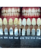 トウキョースワーズ 渋谷店(TOKYO SWRS)/#ホワイトニング #渋谷 #池袋