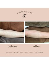 ナナ(nana)/◆before/after◆