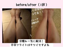 ヨサパーク ベアトリーチェ(YOSA PARK beatrice)/ハッピー×水素酸素吸入一回