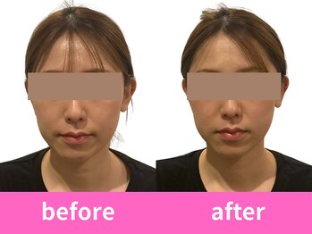 あぐり鍼灸整骨院/