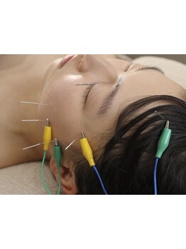 鍼灸施術を受けたい