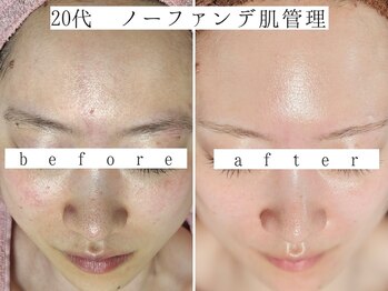 ユウビジン(YOU美人)/