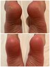ガサガサ踵×だる重脚撃退／かかと美人フットケア60分6200円