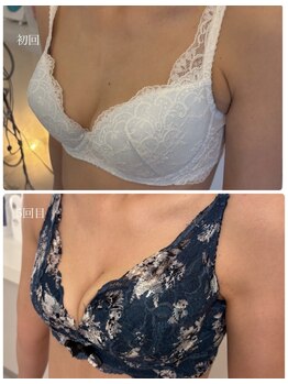 ルフルリール(Refleurir)/◆バストアップ症例/育乳◆