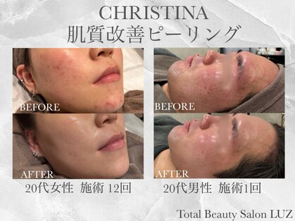 トータルビューティーサロン ルース(LUZ)の写真