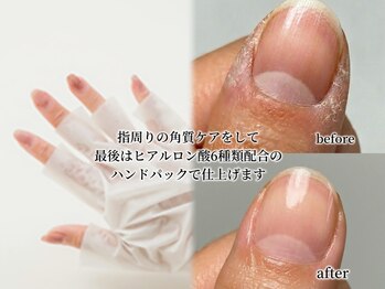 クオン(KUON)/角質ケア＋ヒアルロン酸パック