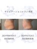 【2回目以降】【身体メンテ】ラジオ波(RF)+キャビテーション+マシンカスタム