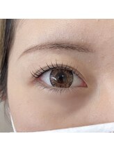 オルト(ORT)/ラッシュリフト