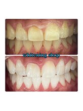 ホワイトニングショップ 所沢店/ホワイトニングショップ所沢店