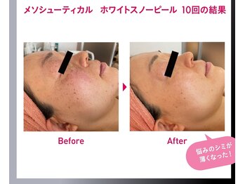 オレンジバナナ 新潟店/【ホワイトスノーピール】